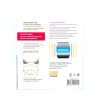 Виброопоры WiMAX